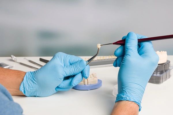 Dental Crown Vs Dental Bridges For Tooth Replacement